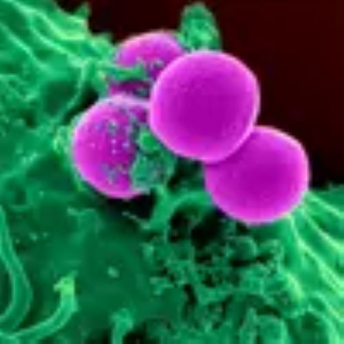 chelt therapy 011111